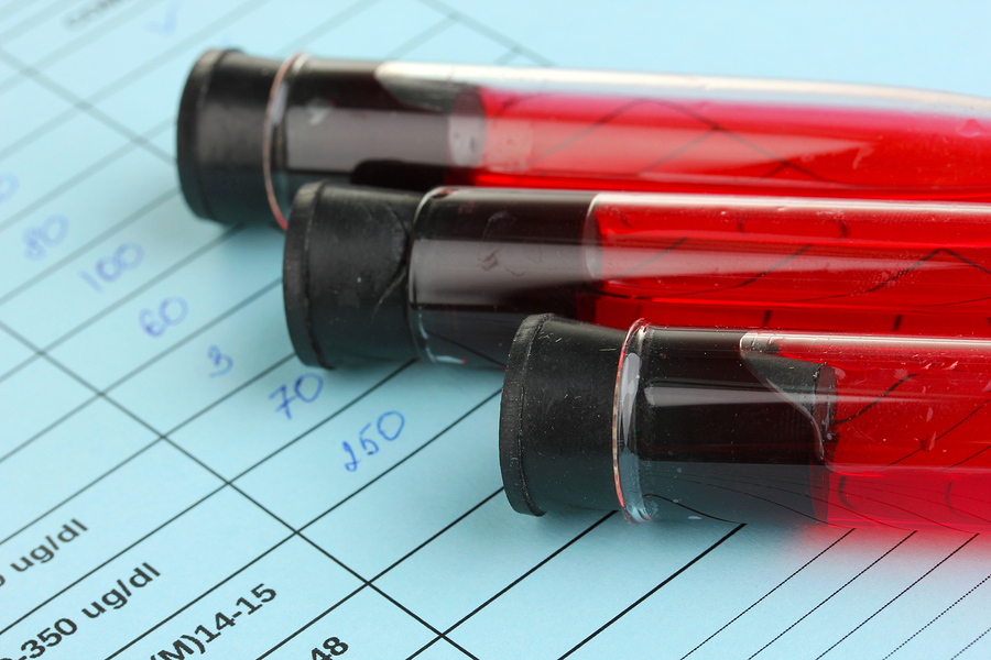 Blood in test tubes and results close up